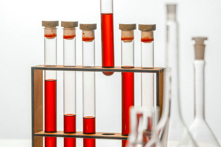 濁度單位 濁度單位